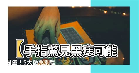 手長黑斑|別把癌當痣！5部位冒黑點恐是惡性黑色素瘤 台大醫師。